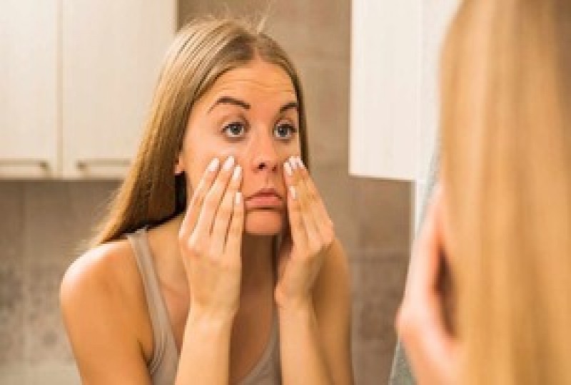 6 mẹo xử lý nhanh bọng mắt