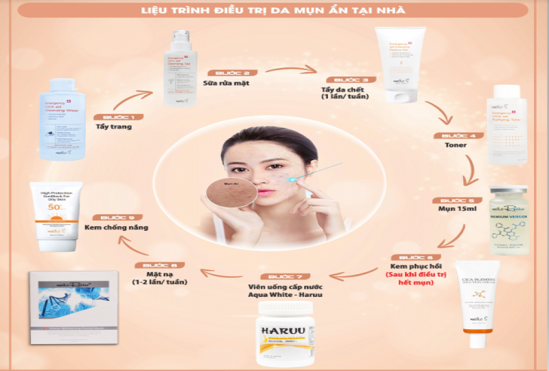 LIỆU TRÌNH PHỤC HỒI DA MỤN ẨN