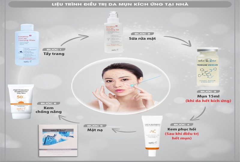LIỆU TRÌNH PHỤC HỒI DA MỤN KÍCH ỨNG